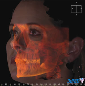 顎顔面形態の3次元的評価・研究に期待 （株）理経、横浜市立大学医学部に3次元サーフェィス超高速撮影＆解析システム 「3dMDface system」を納入